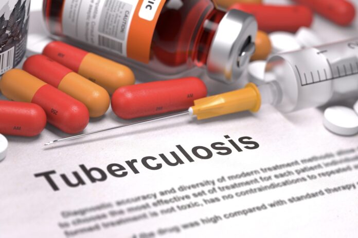 Diagnosis - Tuberculosis. Medical Concept.